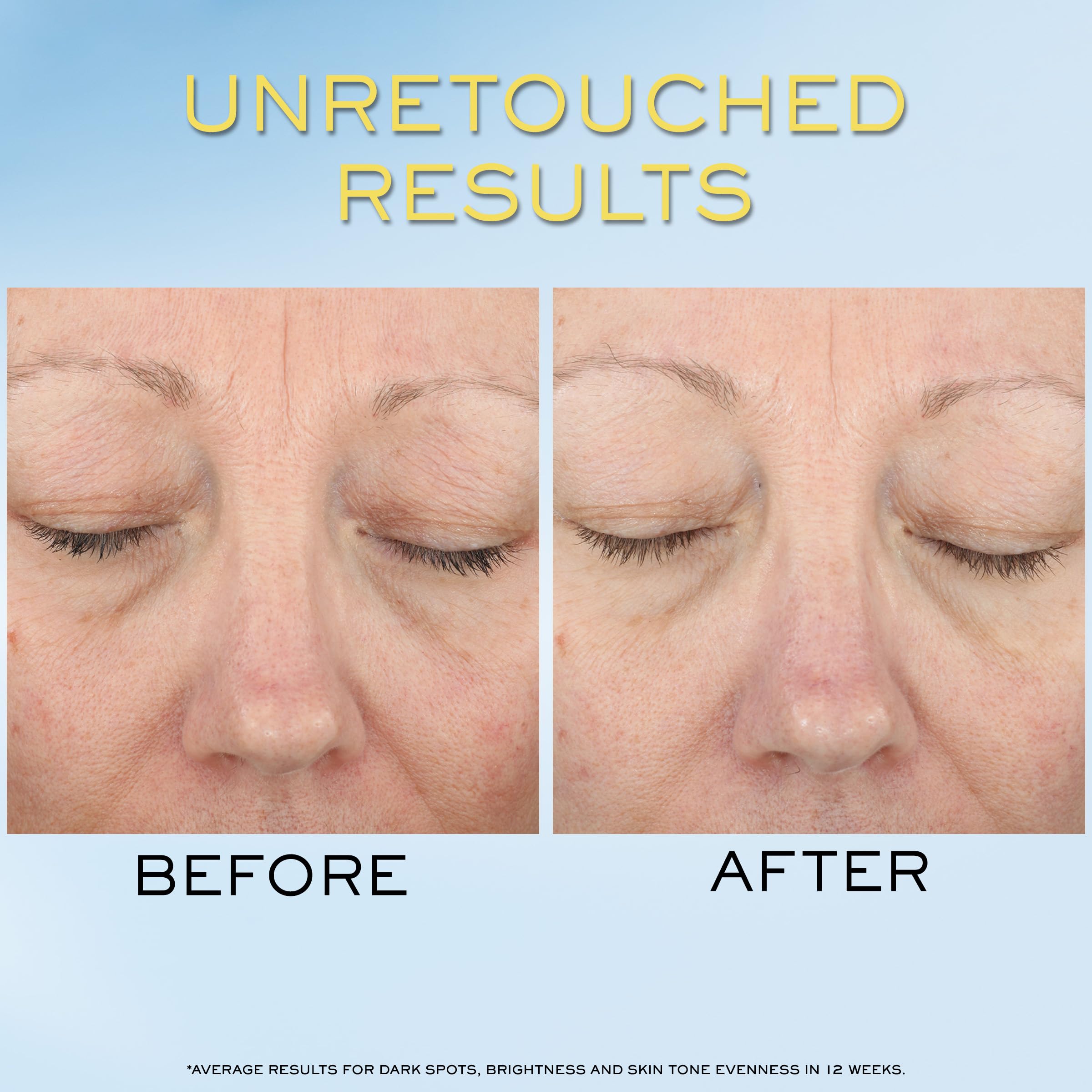 Lancôme Supra Screen SPF 50+ banner communicates dependable sun protection.