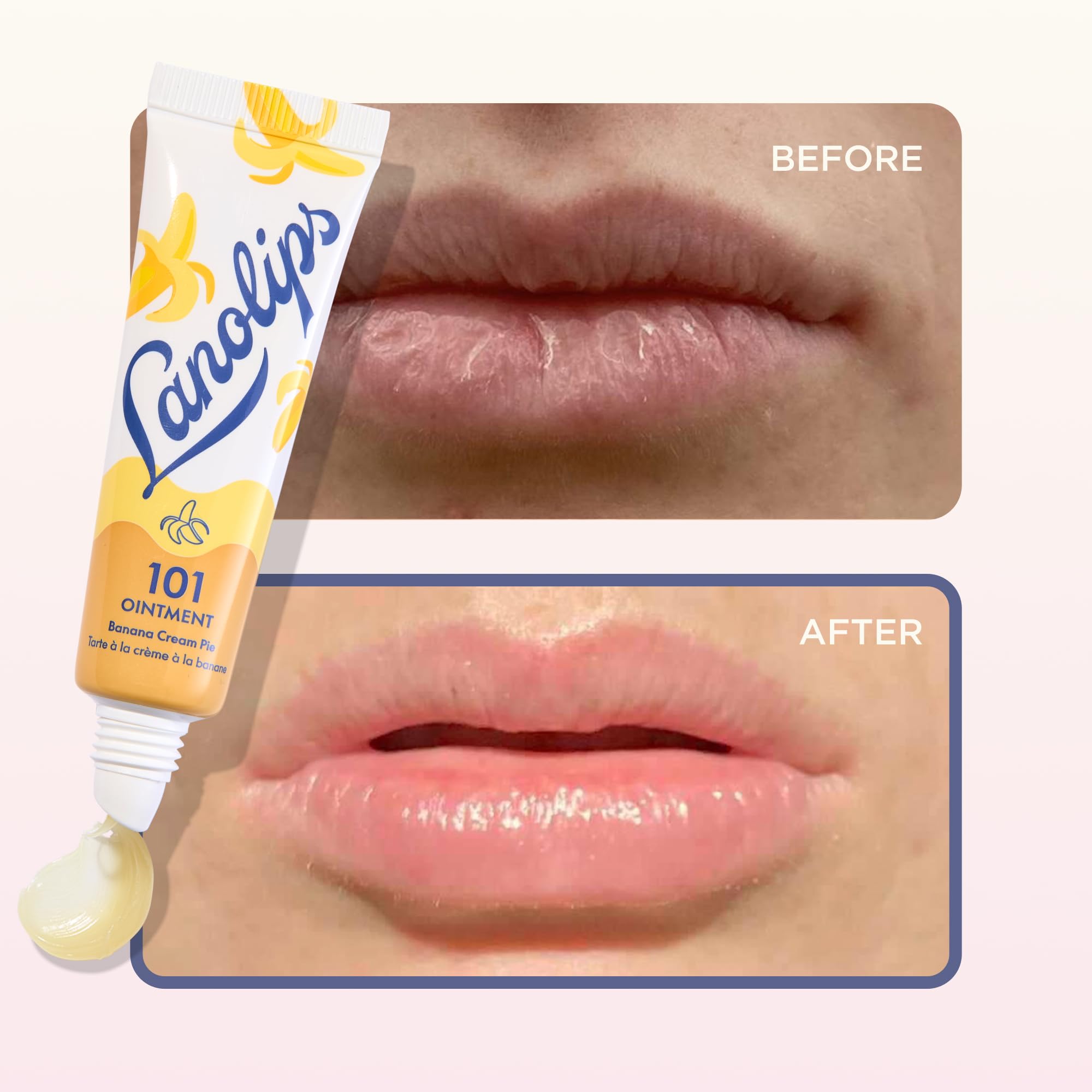 Cuidado de cutículas con Lanolips 101 Ointment