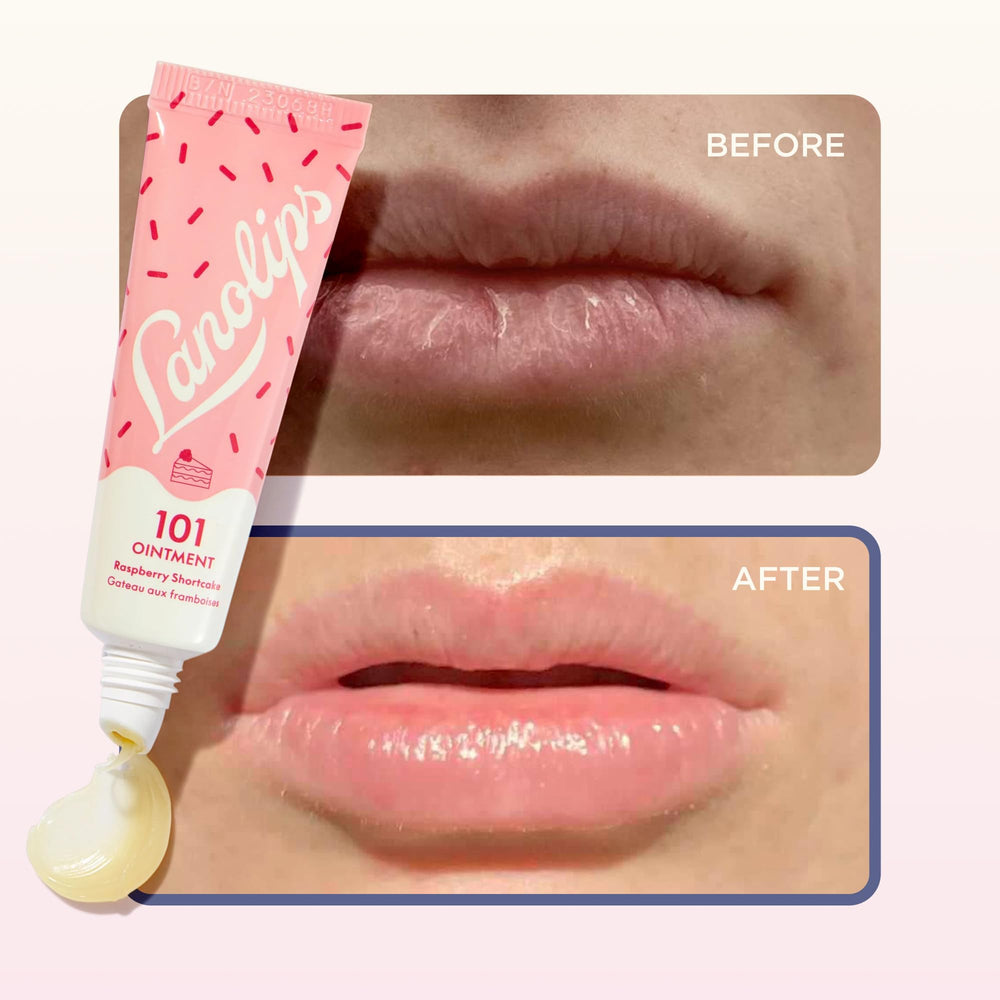 Lanolips 101 Ointment Raspberry Shortcake, envase de 0,52 oz para llevar contigo.