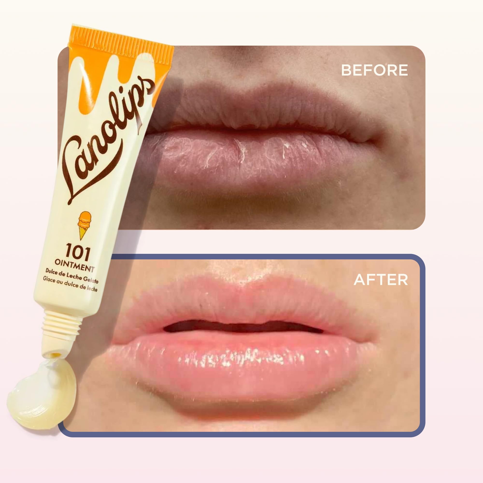Lanolips 101 Unguento envase 0-35oz práctico para el bolso.