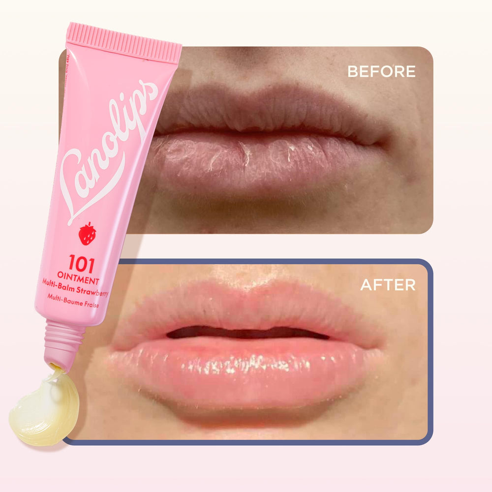 Lanolips 101 ungüento sin crueldad para piel sensible.