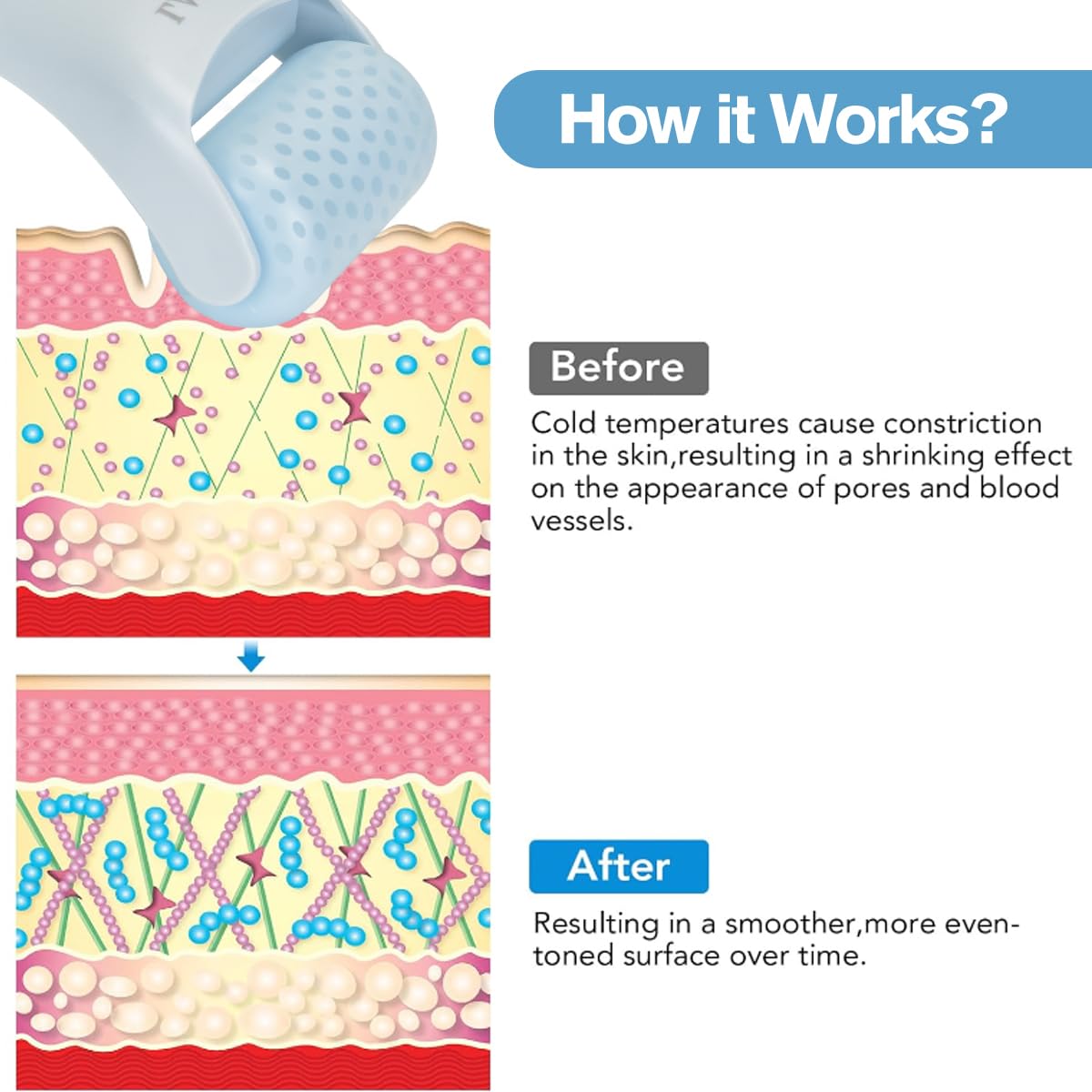 LATME Ice Roller provides a soothing body massage for daily relief.