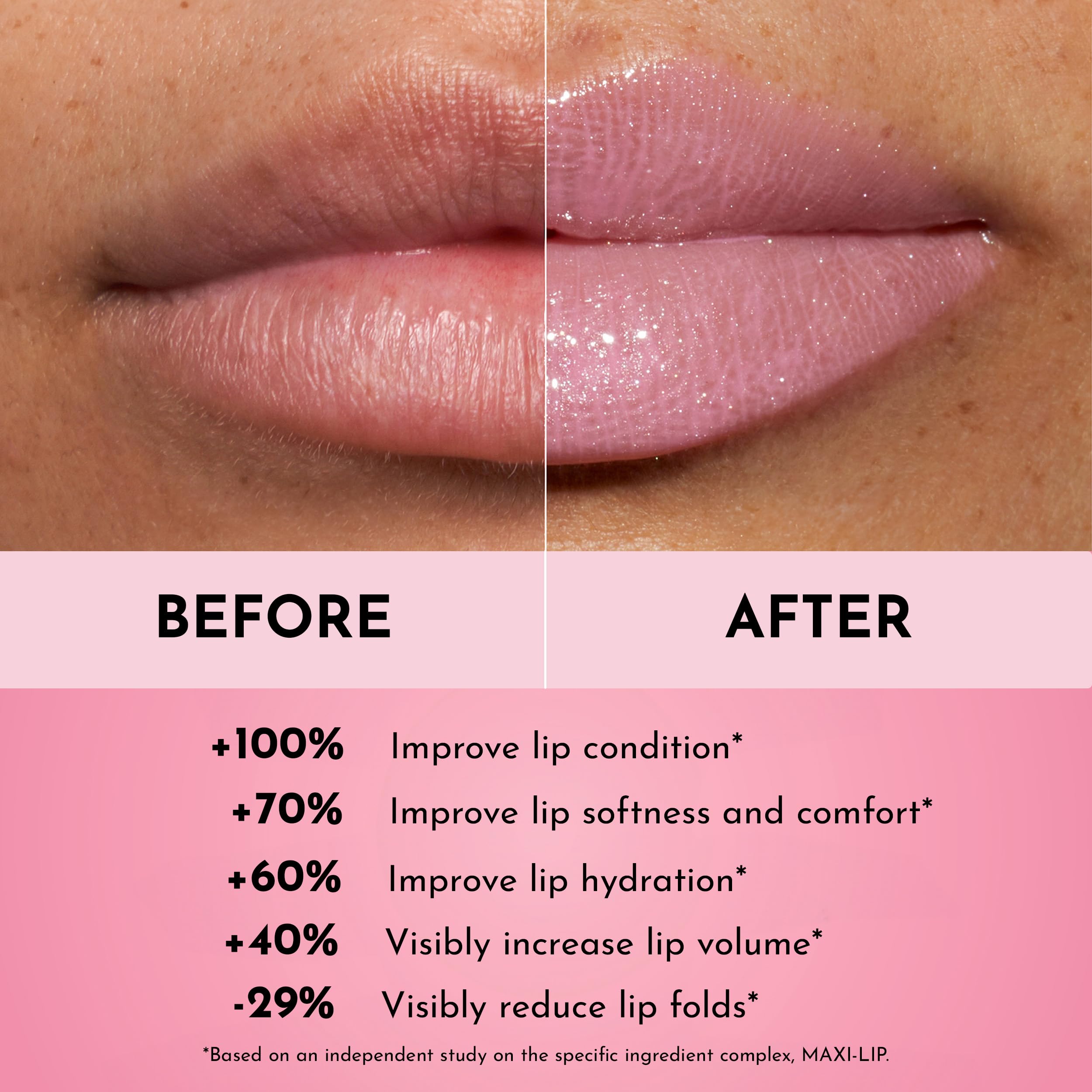 LAWLESS Forget the Filler Daisy Girl on lips demonstrating subtle fullness and smooth lines.