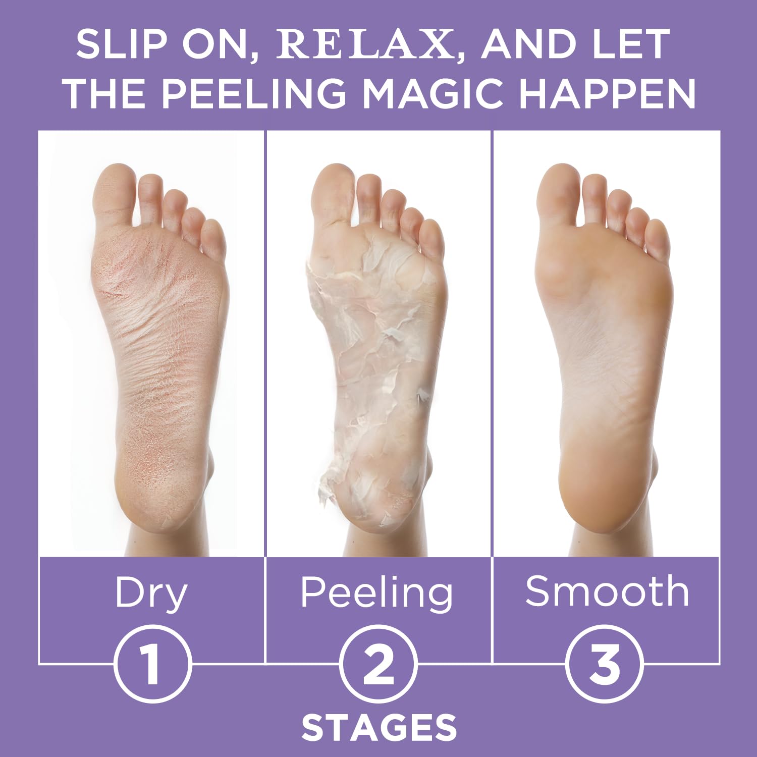 Lee Beauty Mandelic and Lactic Acid exfoliation on feet.