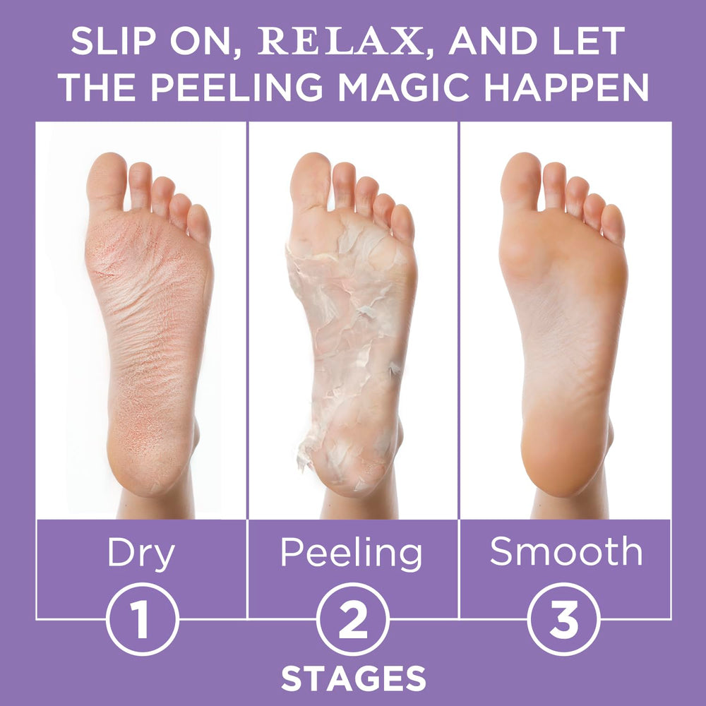 Lee Beauty Mandelic and Lactic Acid exfoliation on feet.