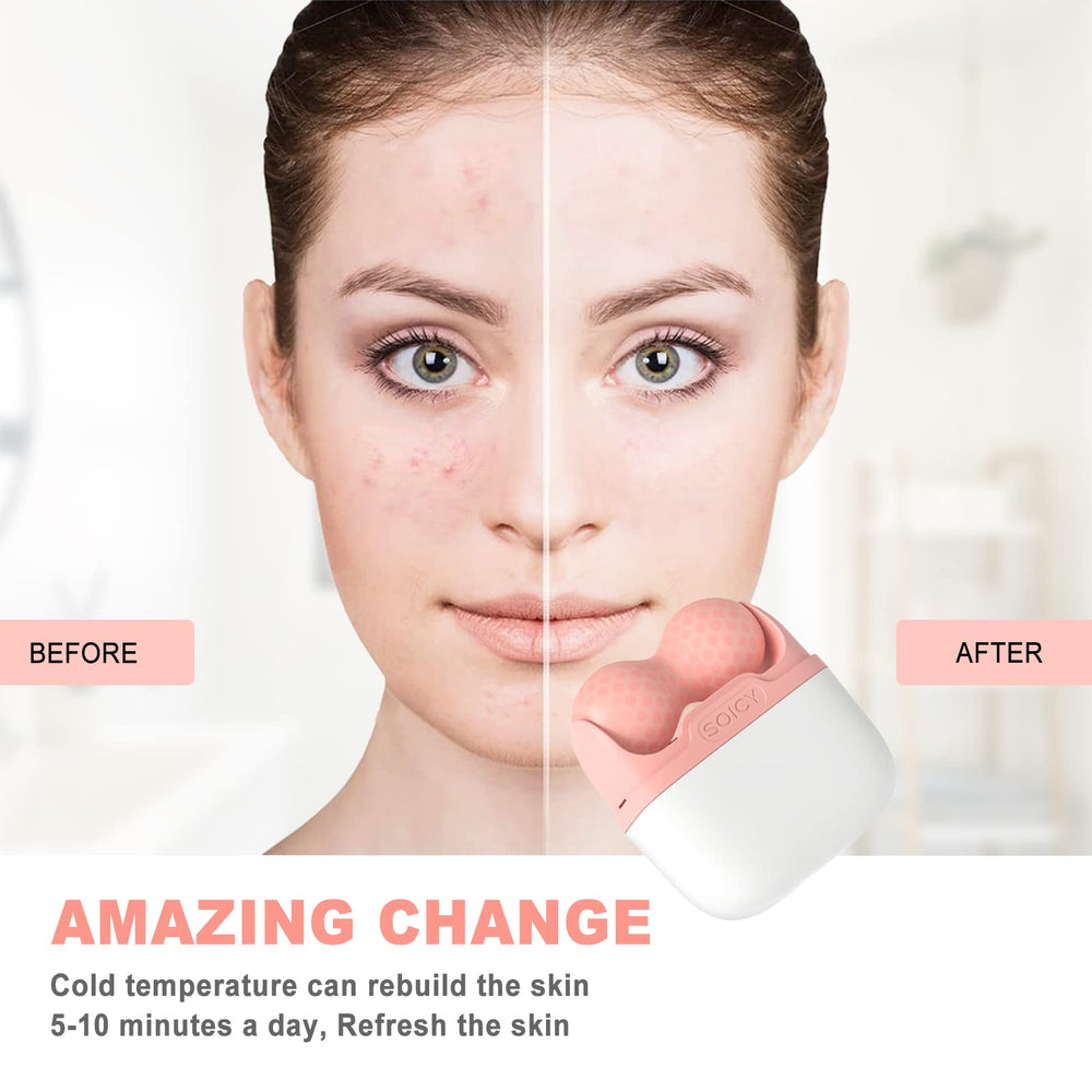 Leeshine Ice Roller pores-texture: cool compression may refine skin texture.