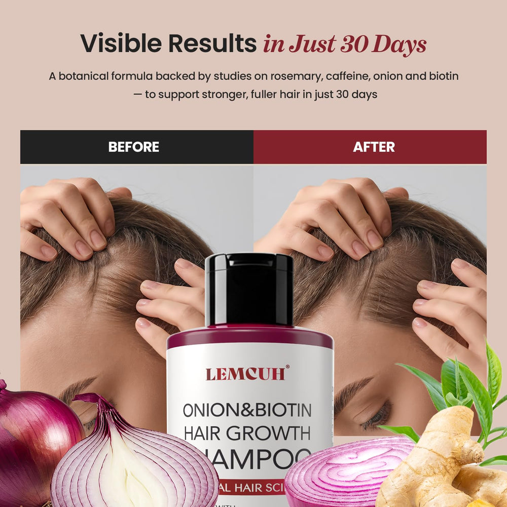 Lemcuh Champú Romero con Cebolla y Biotina, cabello con aspecto más voluminoso y saludable.