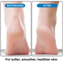 Lenpestia foot scrubber moderate side softens skin