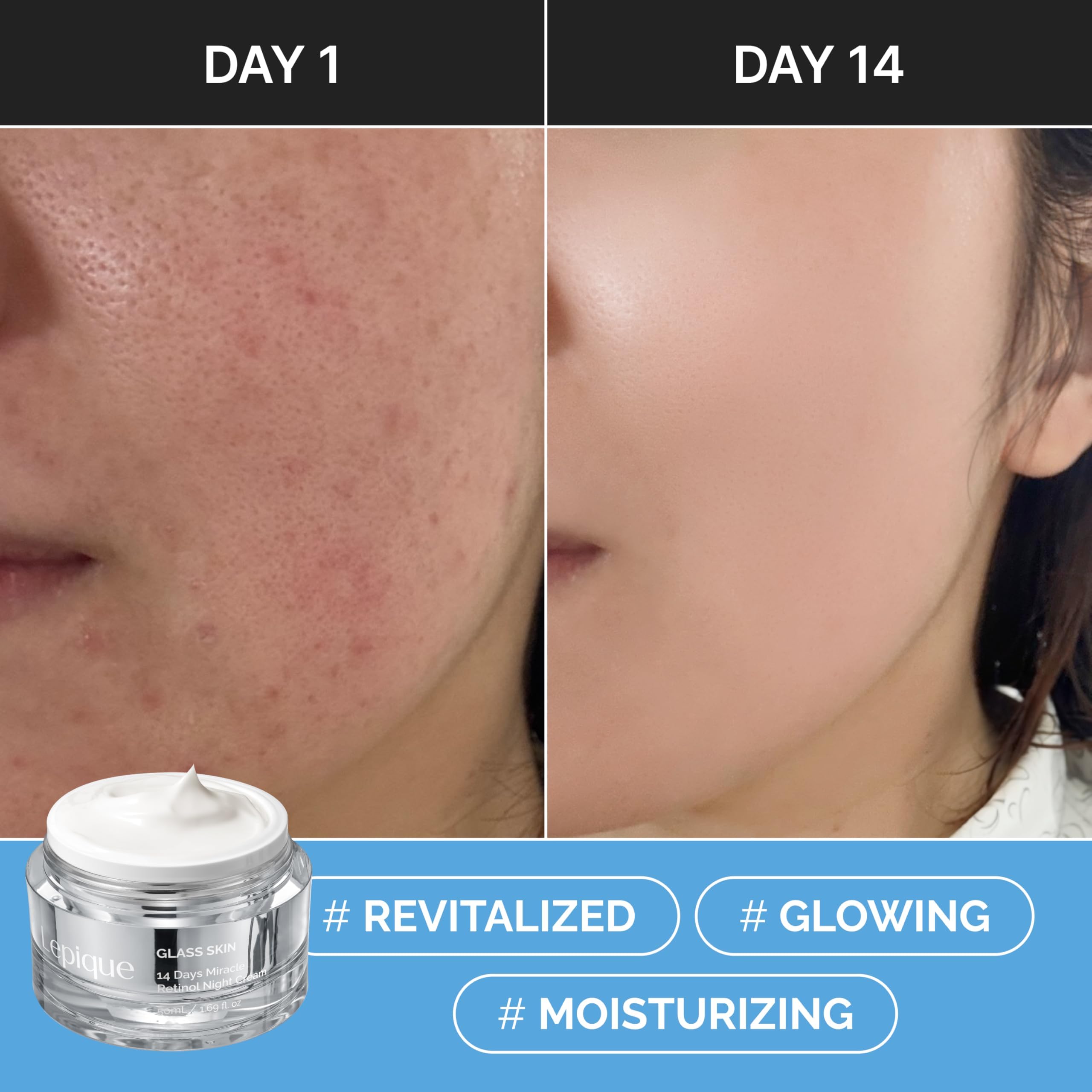 Lepique Retinol Night Cream jar details emphasize premium packaging and ingredient blend.