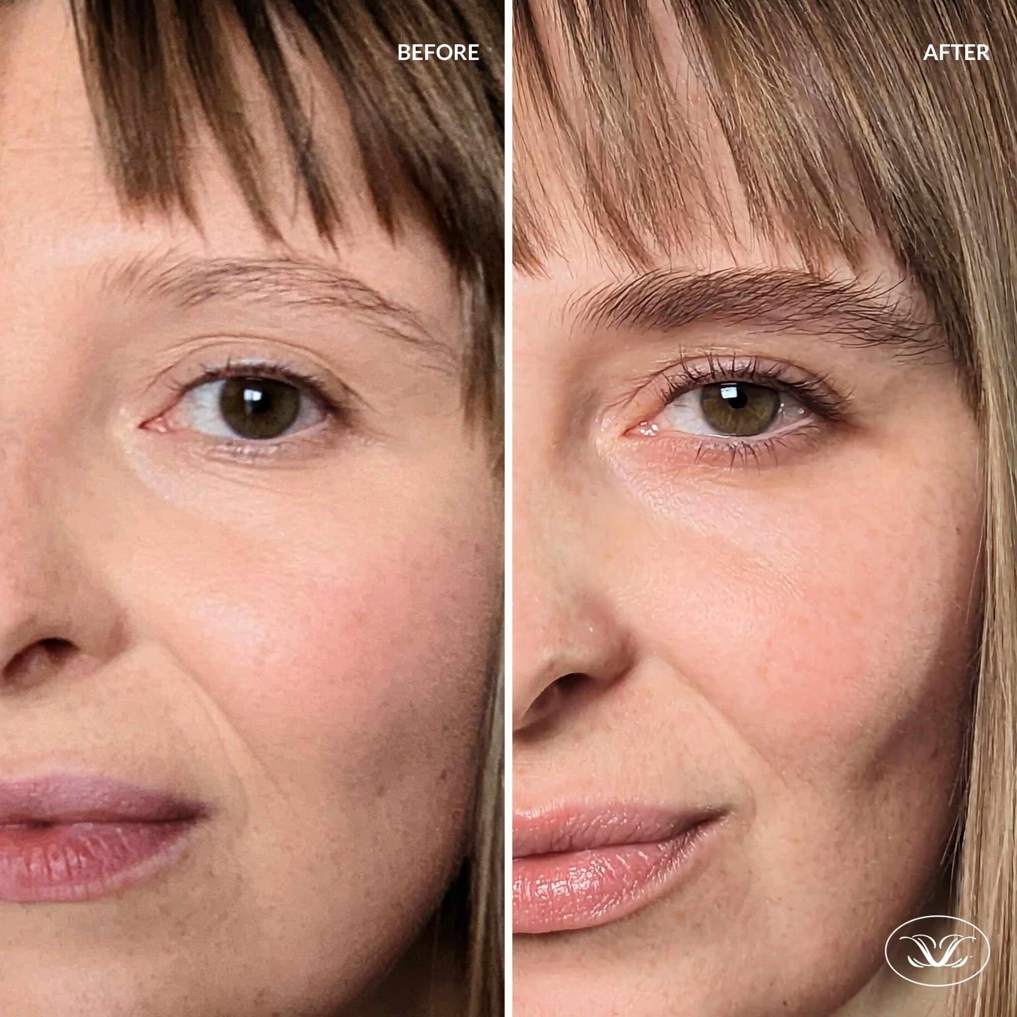Compact 3mL LiBrow tube packaging for 90-day supply