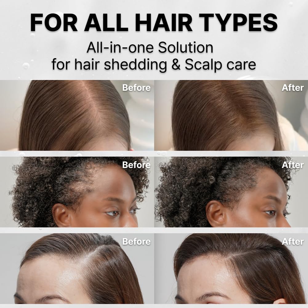 LilyEVE GROWTURN calming extracts help soothe dryness and scalp irritation.