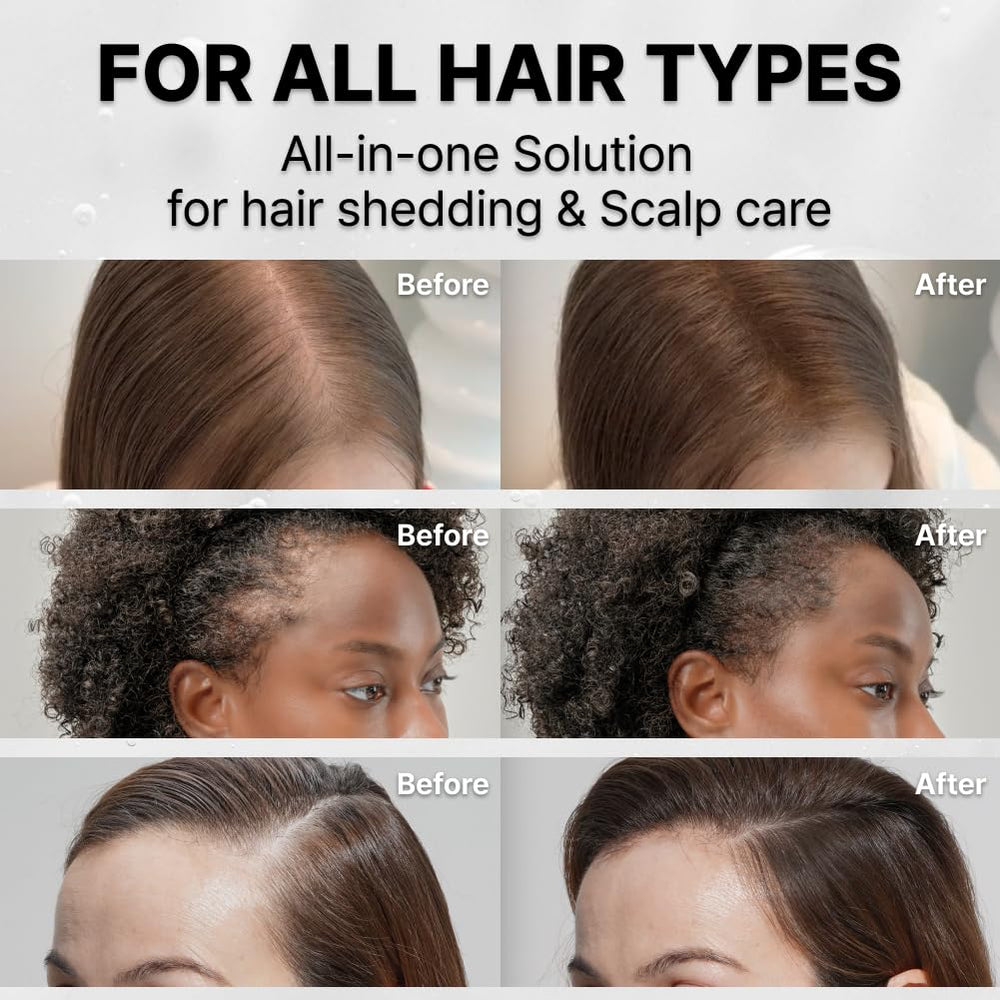 LilyEVE GROWTURN calming extracts help soothe dryness and scalp irritation.