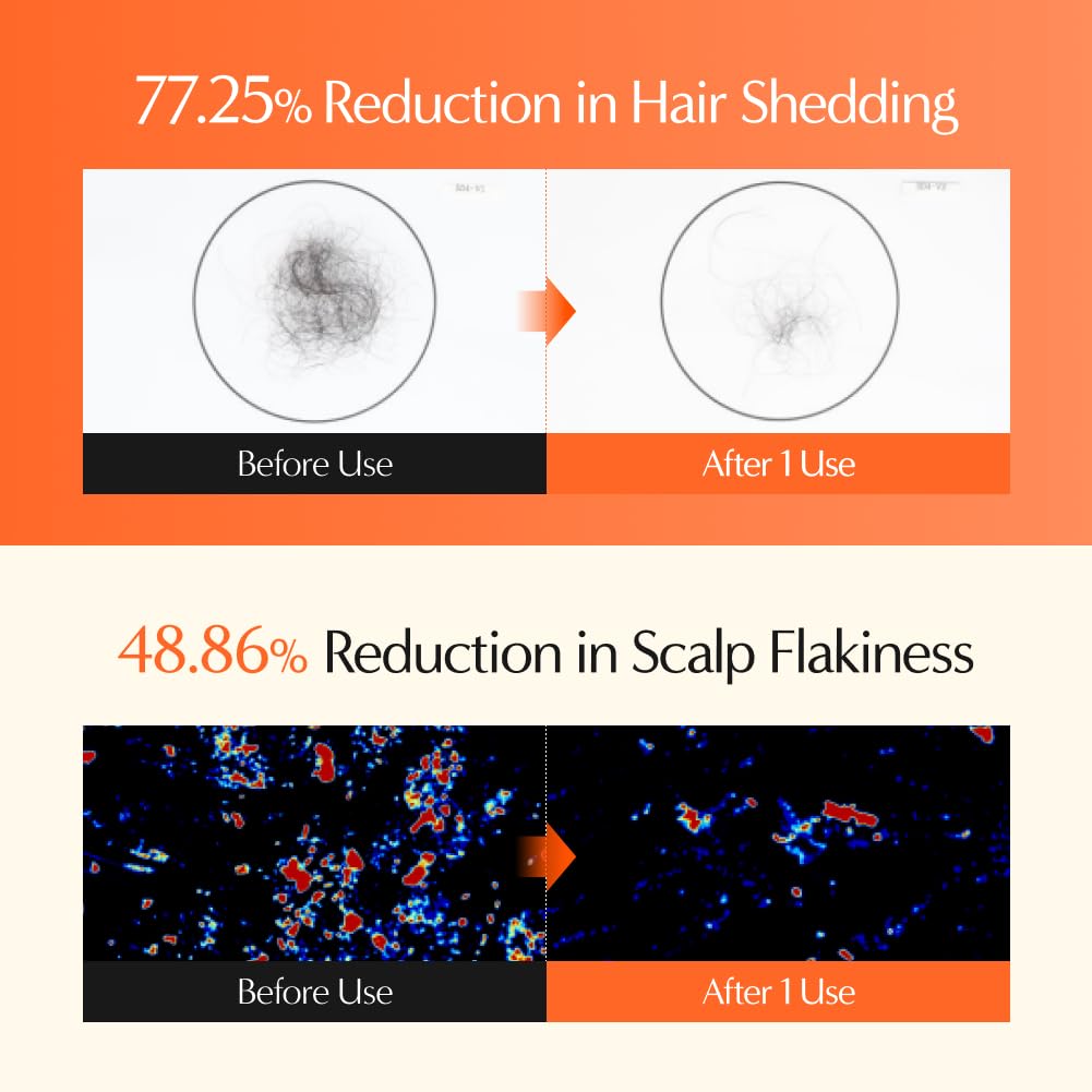 LilyEve GrowTurn root-strength complex supports stronger, denser-looking strands.