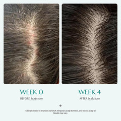 Lily Eve ScalpTurn serum application close-up highlighting focused scalp care