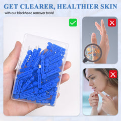 Lishae 70-dots pimple stickers provide hydrocolloid protection and impurity absorption.