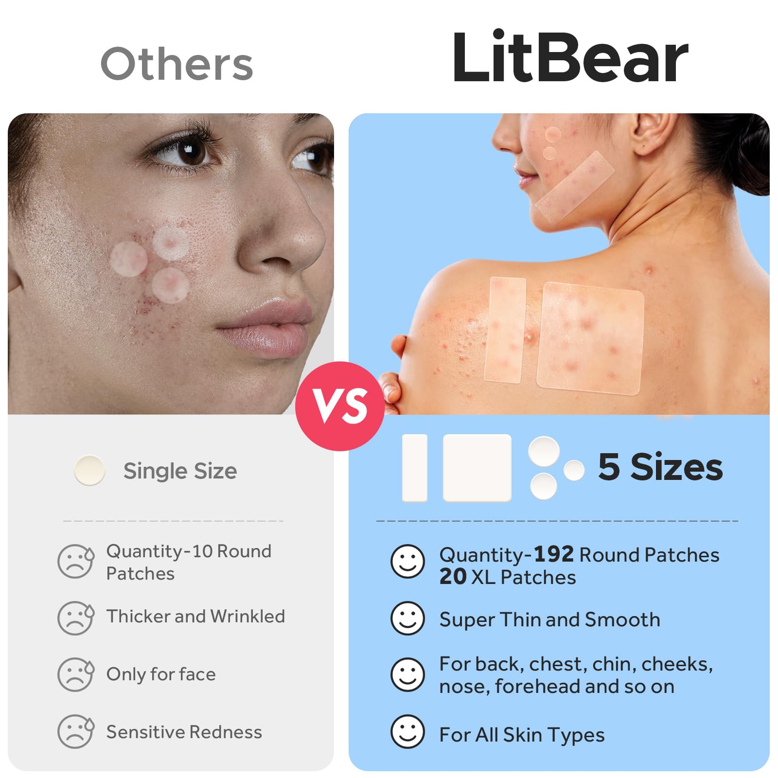 LitBear 212-count patch pack for comprehensive acne care.