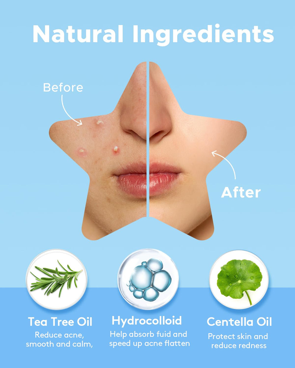 LitBear six-color star patches with playful design for skincare