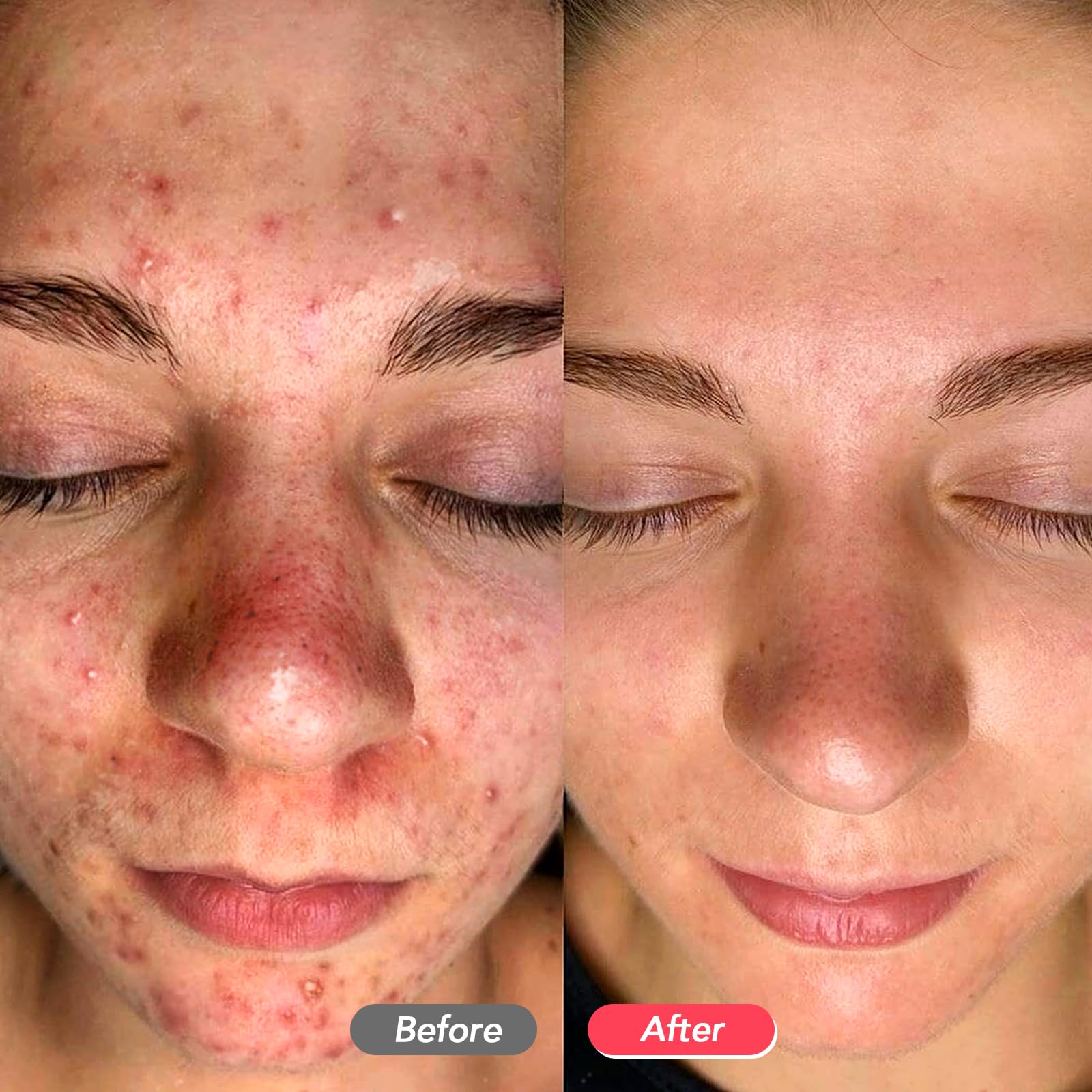 LitBear warm cleansing prep helps open pores for deeper cleaning.
