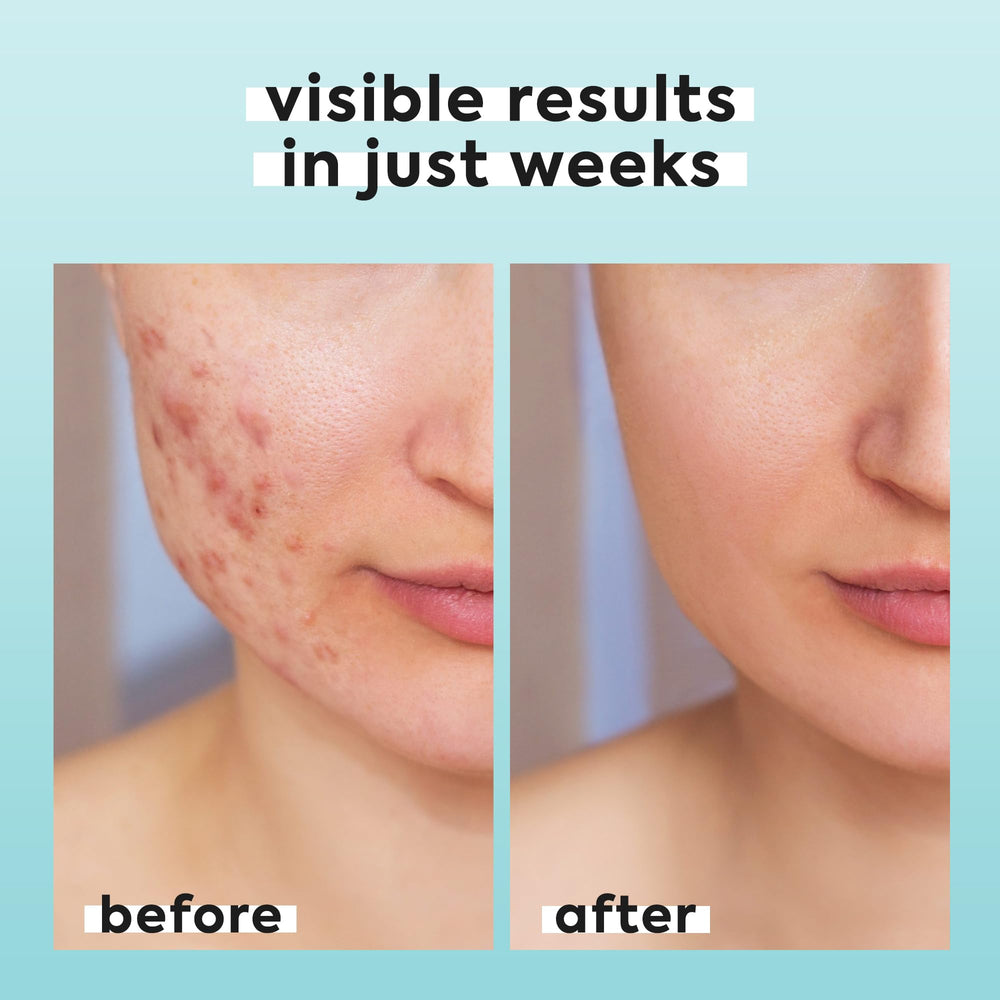 Livaclean envase de viaje para rostro y cuerpo en cualquier lugar