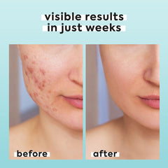 Livaclean envase de viaje para rostro y cuerpo en cualquier lugar