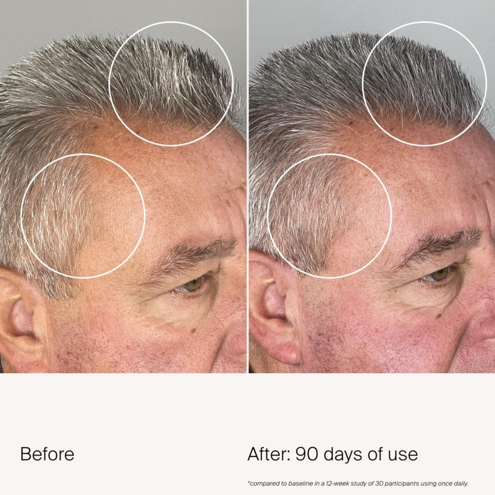 Living Proof Density Serum being dispensed, suggesting even distribution for fuller-looking roots