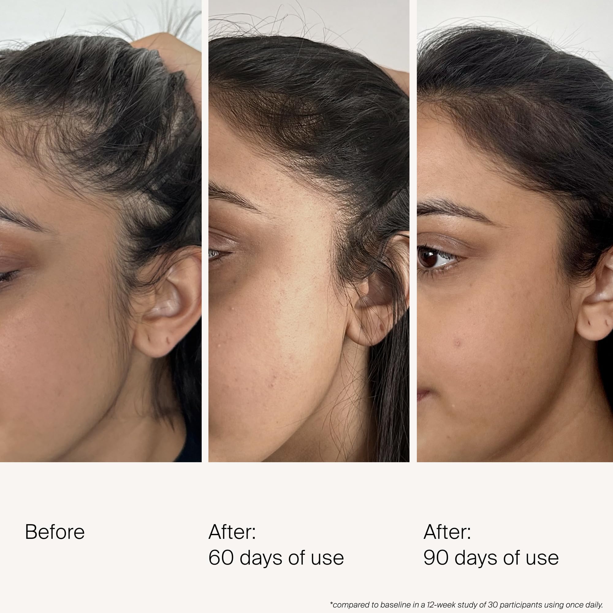 Living Proof Density Serum dropper applying on the scalp demonstrates quick absorption
