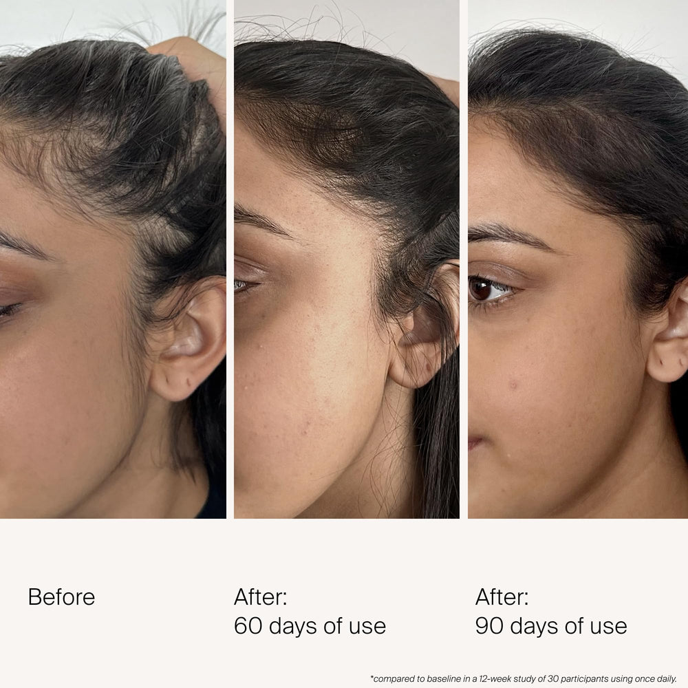 Living Proof Density Serum dropper applying on the scalp demonstrates quick absorption