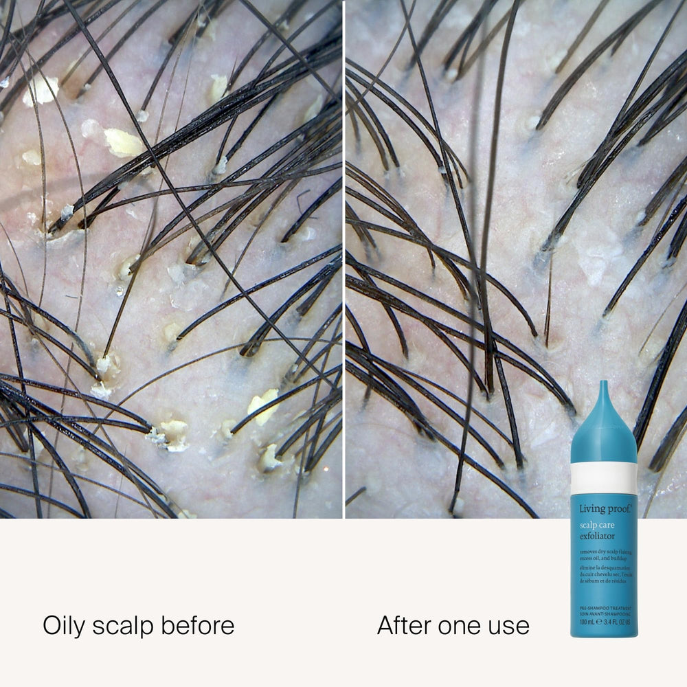 Living Proof Scalp Care Exfoliator applicator tip enabling mess-free spot treatment.