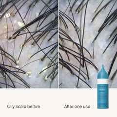 Living Proof Scalp Care Exfoliator applicator tip enabling mess-free spot treatment.