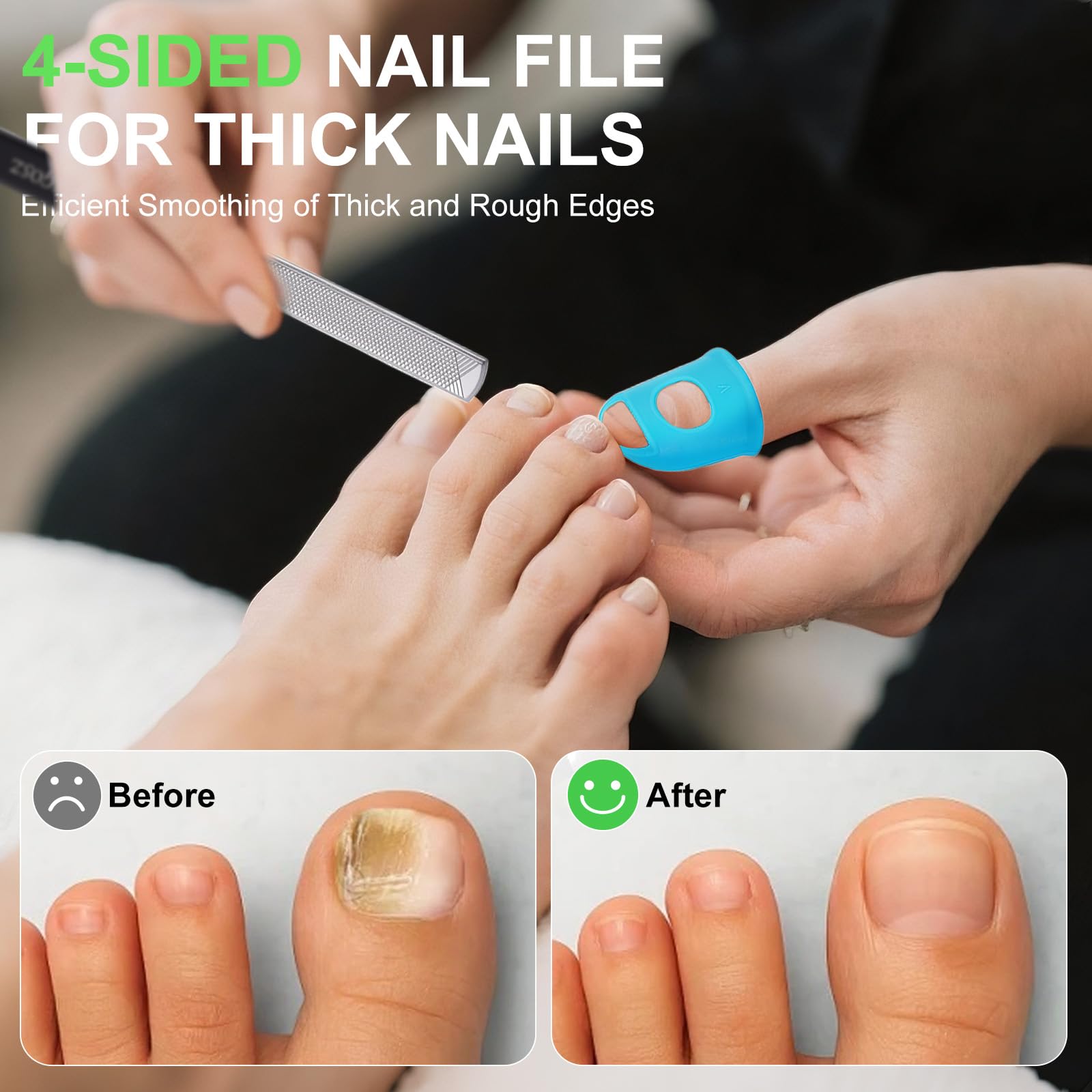 LJCKKGOSZ 4-in-1 toenail set with lifter and guard for easier care.