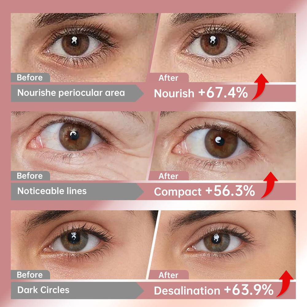 Hydration focus with LLVYUO Novoy Rose Eye Patches hyaluronic acid