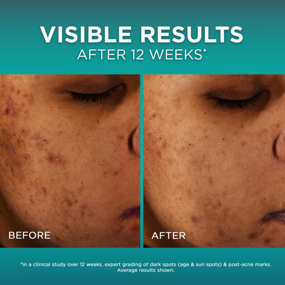 Close-up on Amino Sulfonic and Ferulic components powering gentle exfoliation.