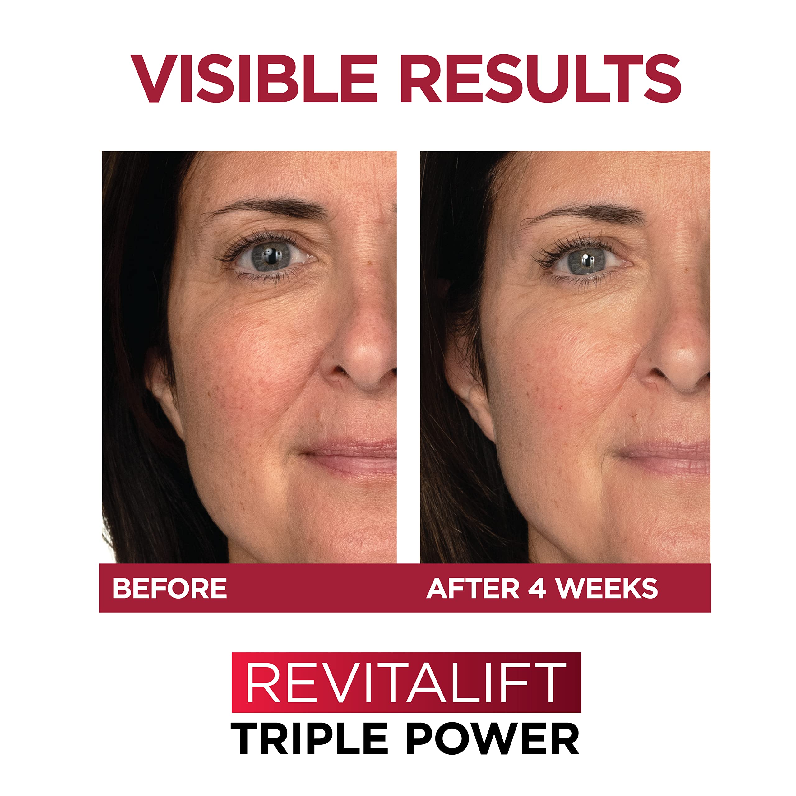 Moisturized skin with Revitalift Day Cream application yields a dewy finish.