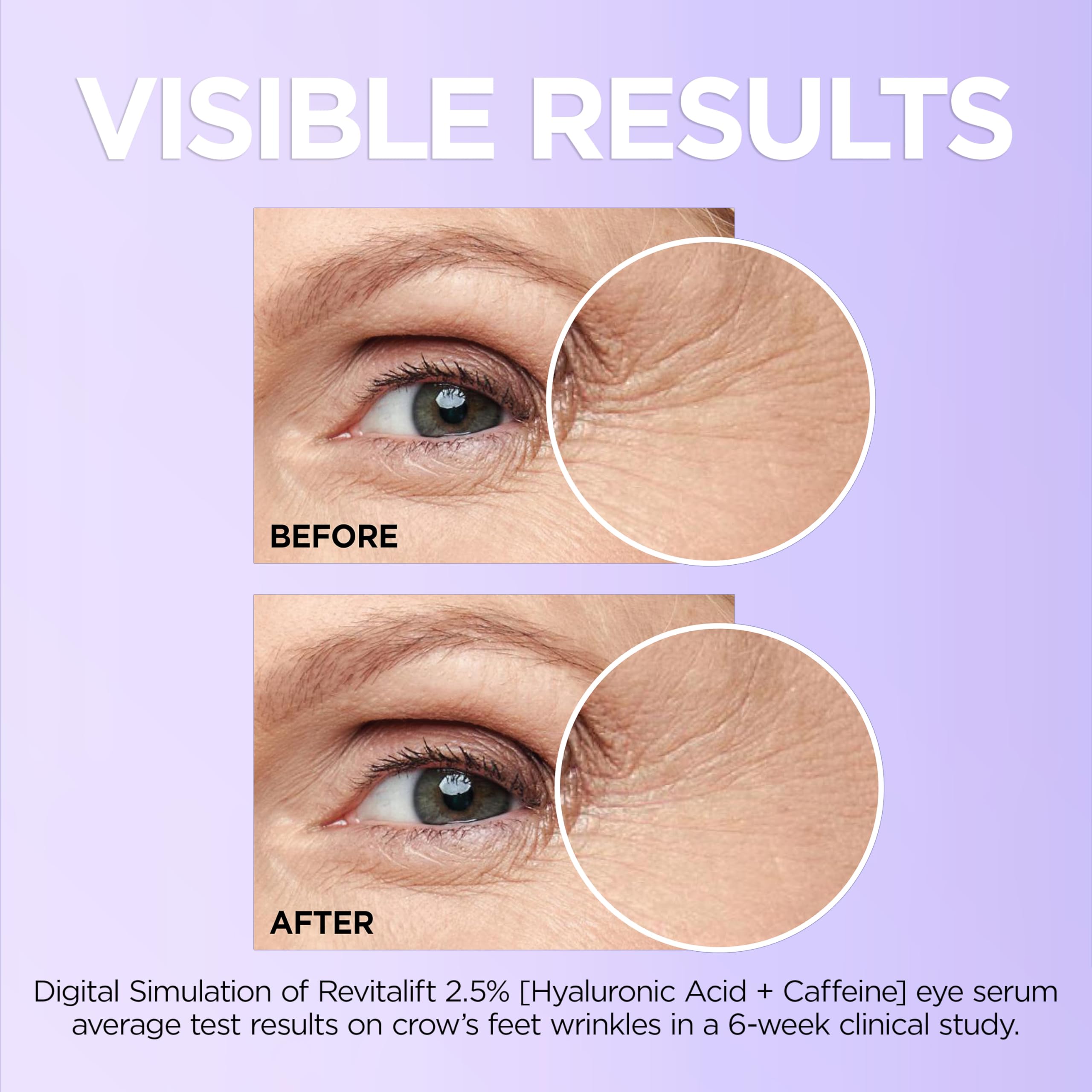 L'Oreal Paris Revitalift eye serum caffeine energizes the eye area