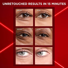 Under-eye area smoothing with Revitalift Triple Power Eye Care product