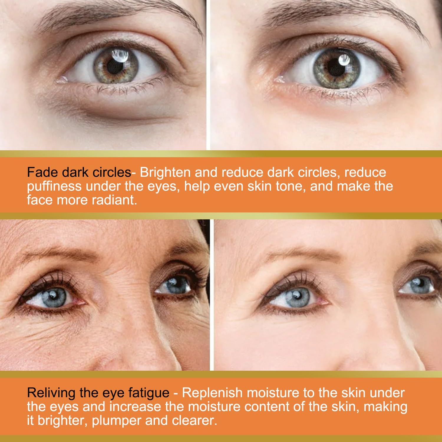 LOYOTICE Contorno de ojos con vitamina C reduce la apariencia de ojeras
