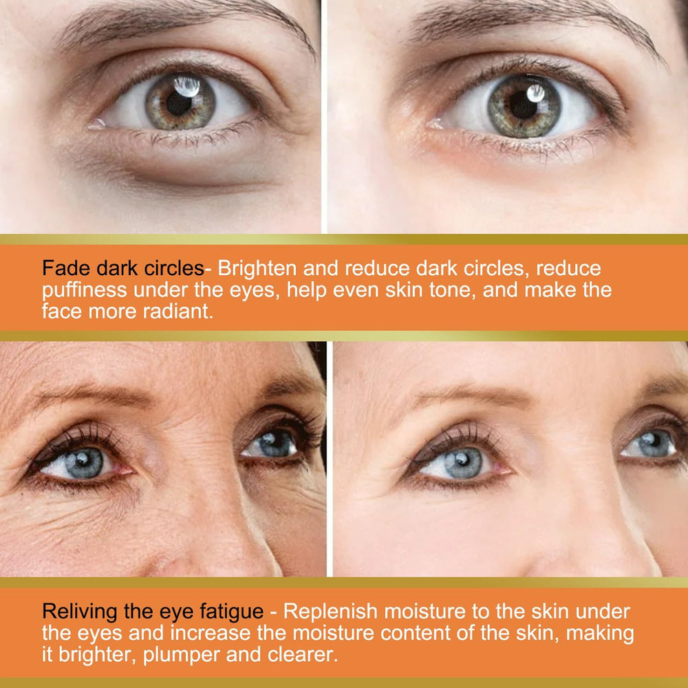 LOYOTICE Contorno de ojos con vitamina C reduce la apariencia de ojeras