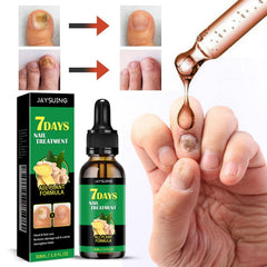 LOYOTICE: cuidado de cutículas con jengibre y curcuma para cutículas hidratadas.