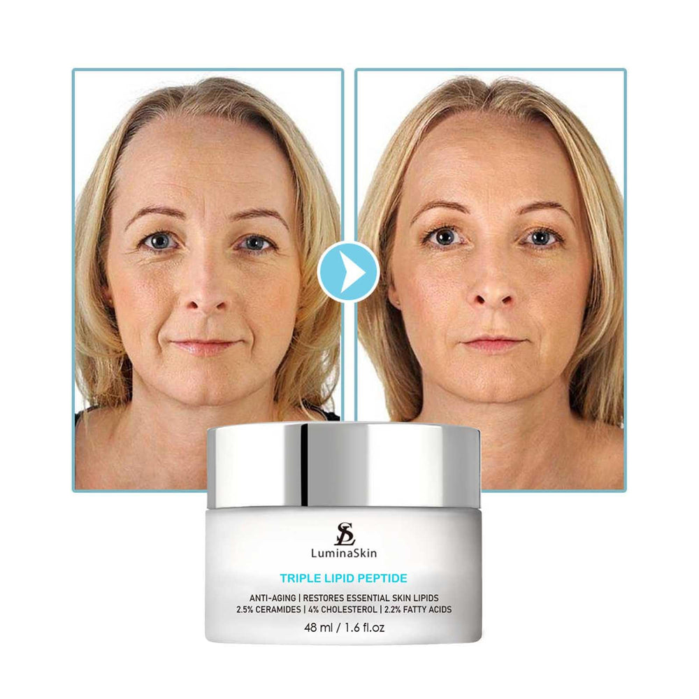 LuminaSkin visible improvement in fine lines and pores after use.