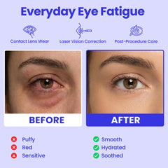 Lure Essentials Steam Eye Mask on eyes delivering soothing warmth after screens
