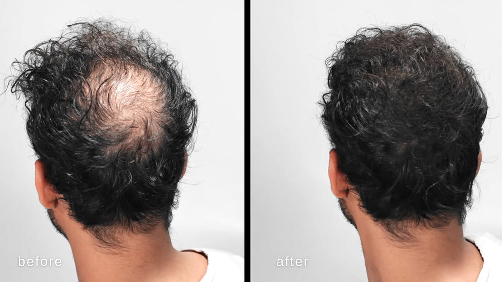 LUXE Hair Building Fibers jar-front demonstrates natural-looking coverage on thinning hair.