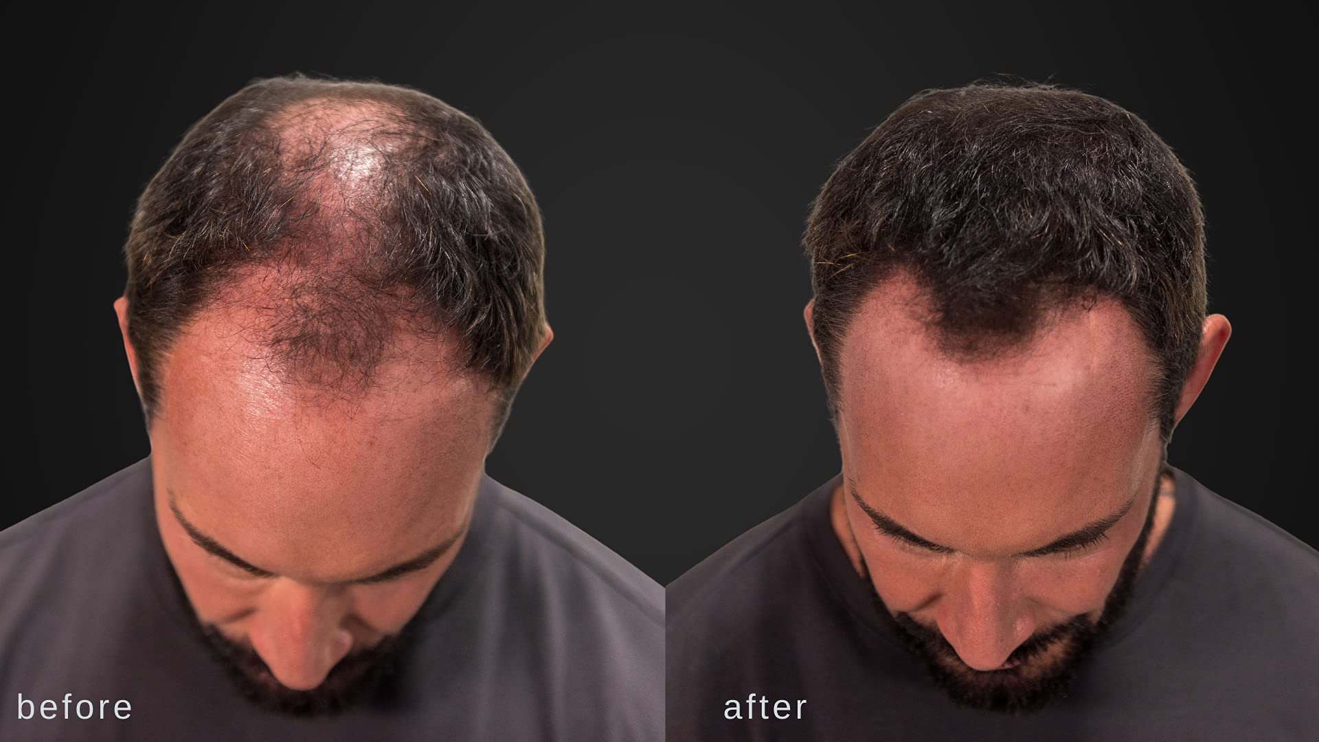 LUXE Hair Building Fibers natural-volume texture reveals undetectable lift and fullness.