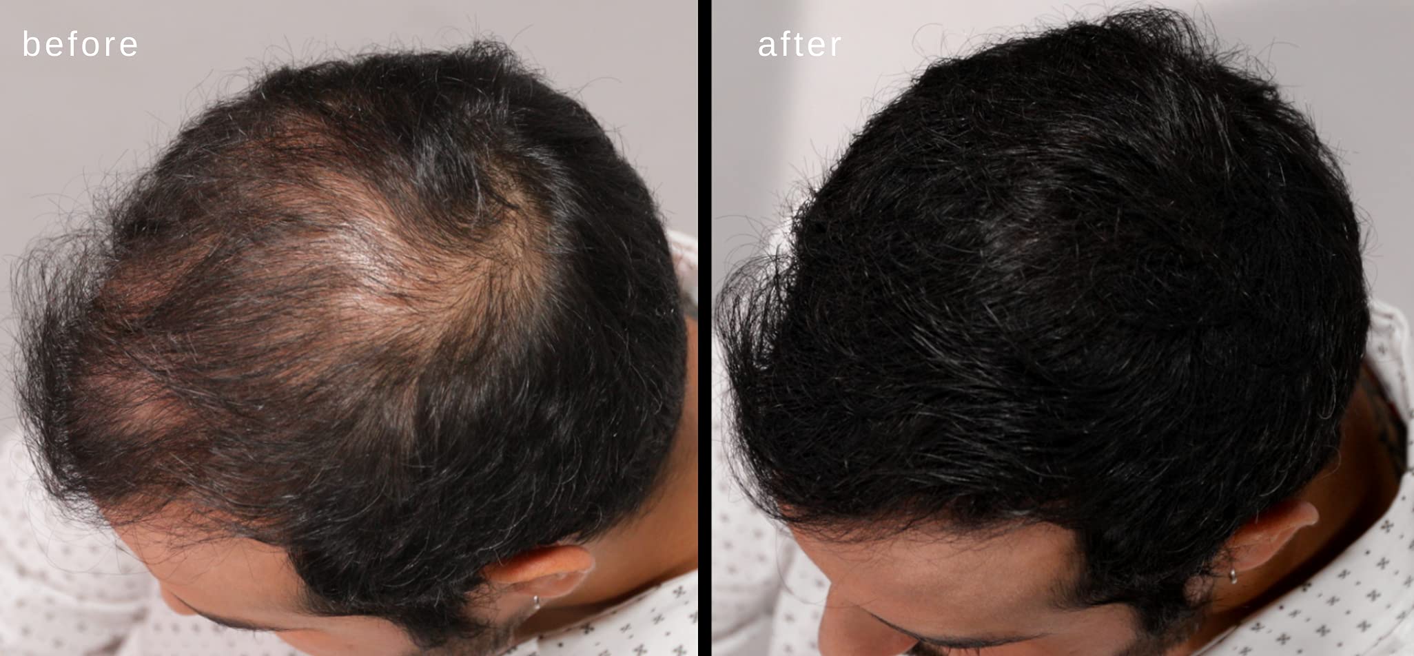 LUXE Hair Building Fibers wind-resistance example suggests fibers stay in place outdoors.