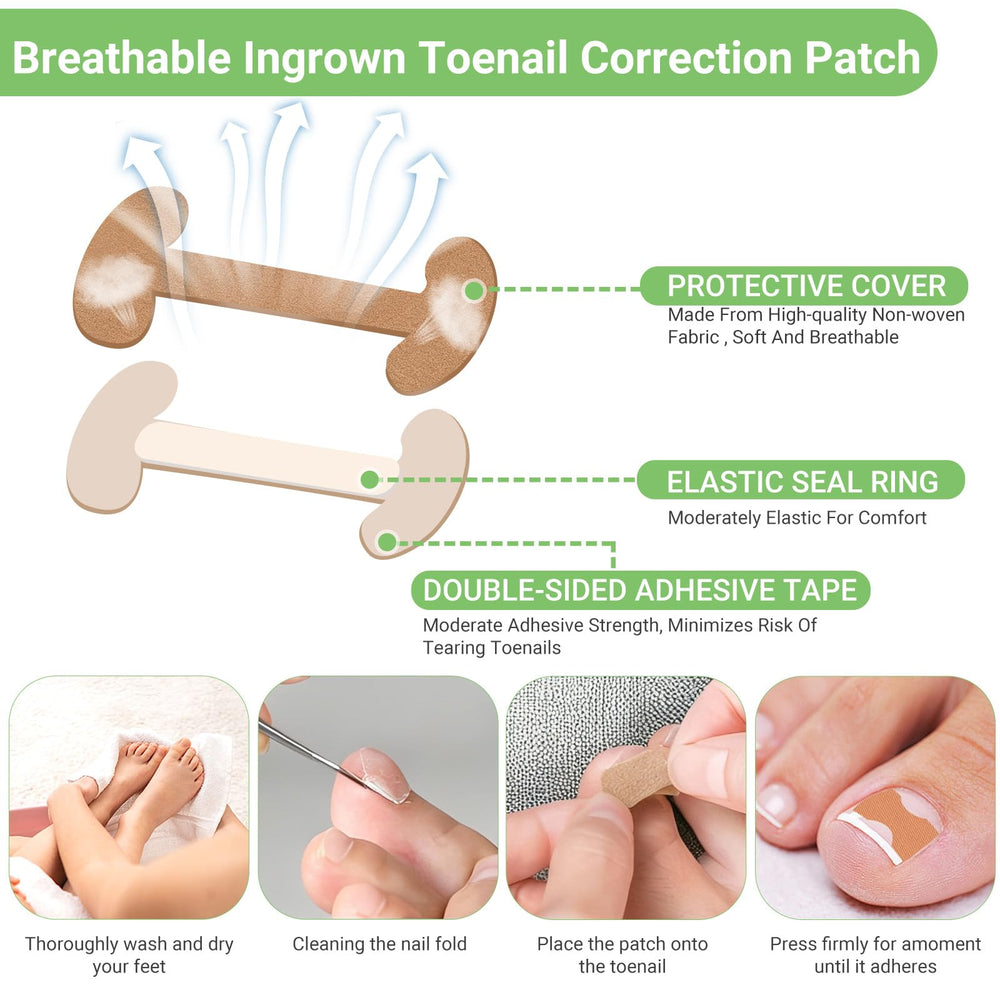 LYNRUI daily wear application of patches and strips for toenail correction