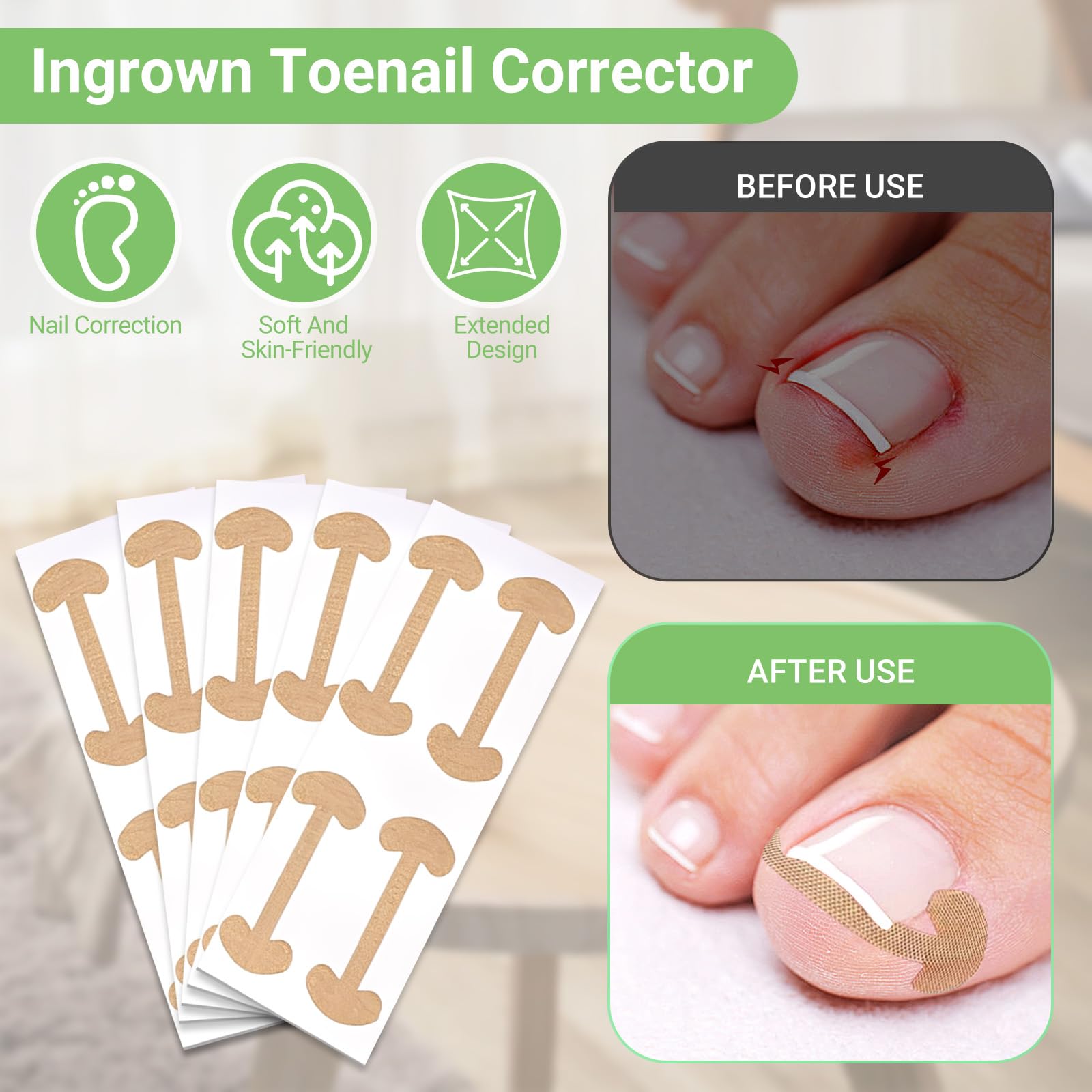 LYNRUI nail file helps smooth edges for safe nail care