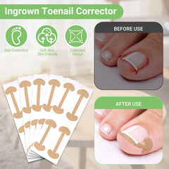 LYNRUI nail file helps smooth edges for safe nail care