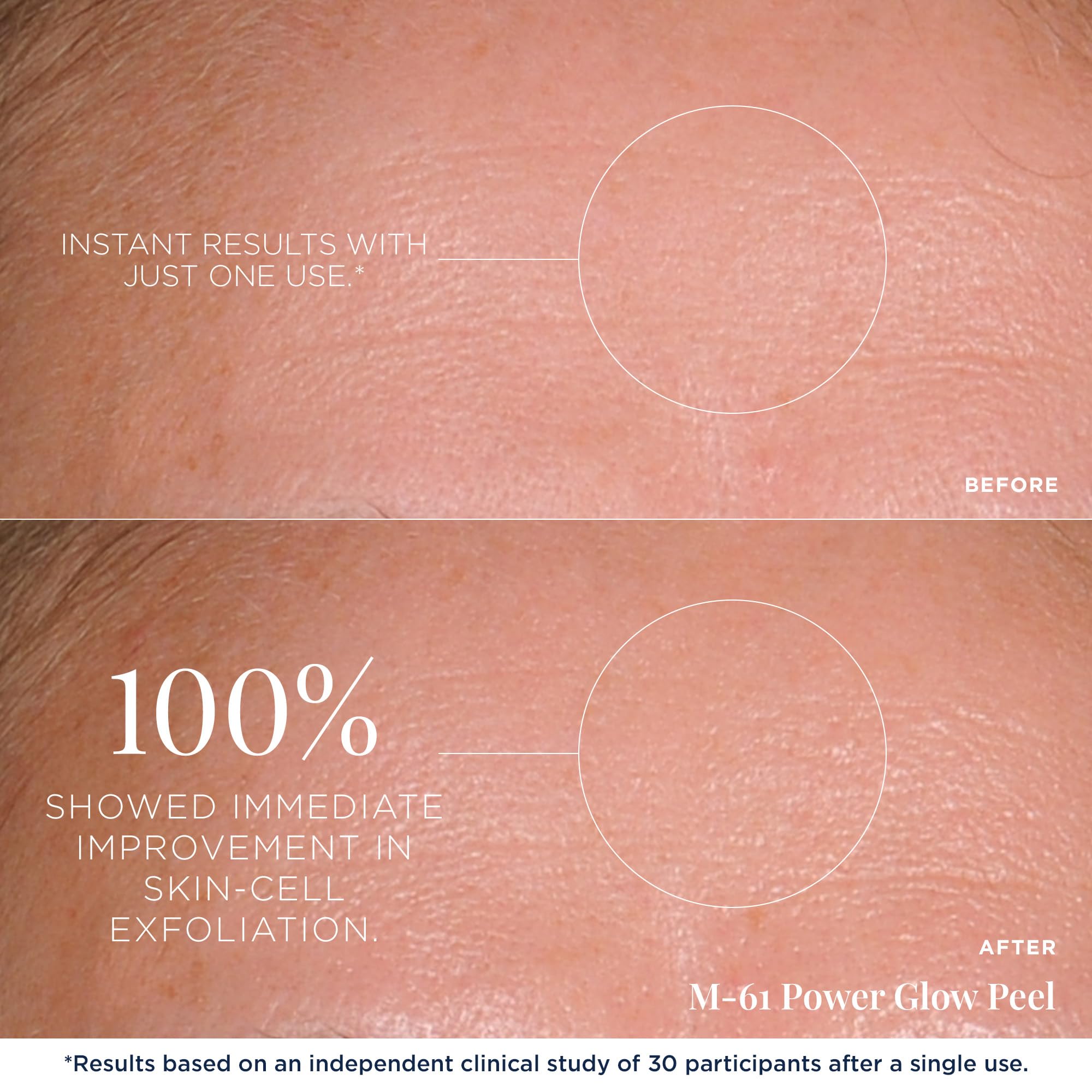 M-61 PowerGlow Peel ingredients include glycolic and salicylic acids
