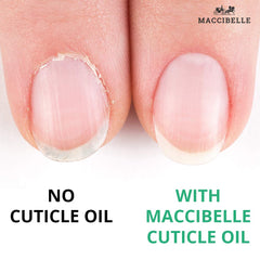 Maccibelle vitamina E nutre cutículas y uñas