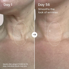 MAËLYS B-POISED neck application on the neck area for targeted care.