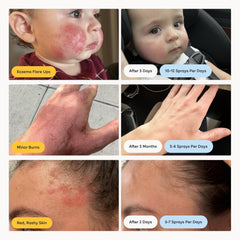 Magic Molecule HOCl spray pore cleanse action in skincare routine